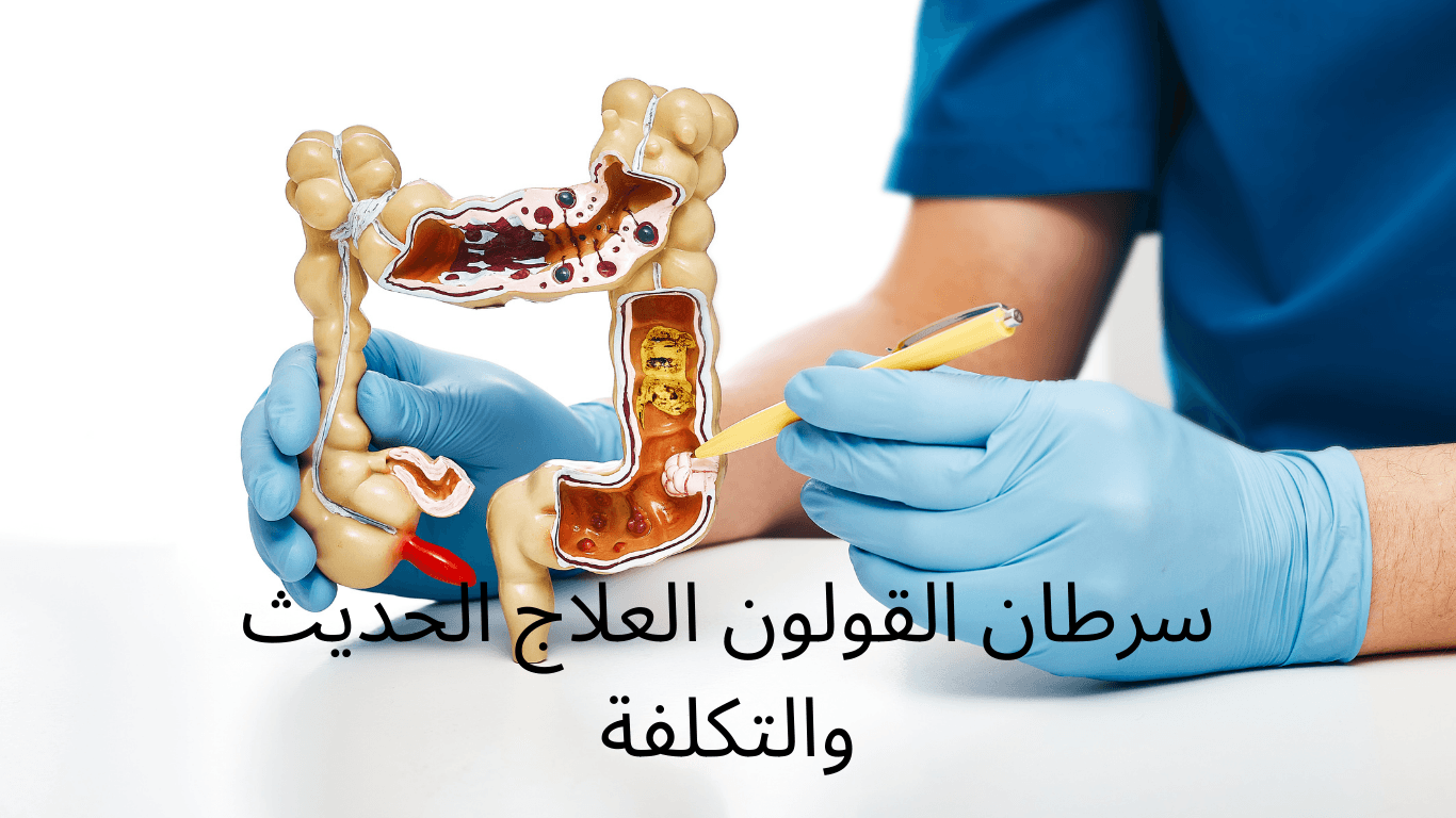 سرطان القولون العلاج الحديث والتكلفة 4 الاطباء