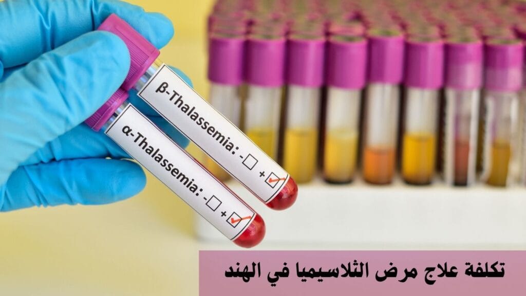 تكلفة علاج مرض الثلاسيميا في الهند